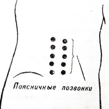 Самомассаж — устраняем диарею